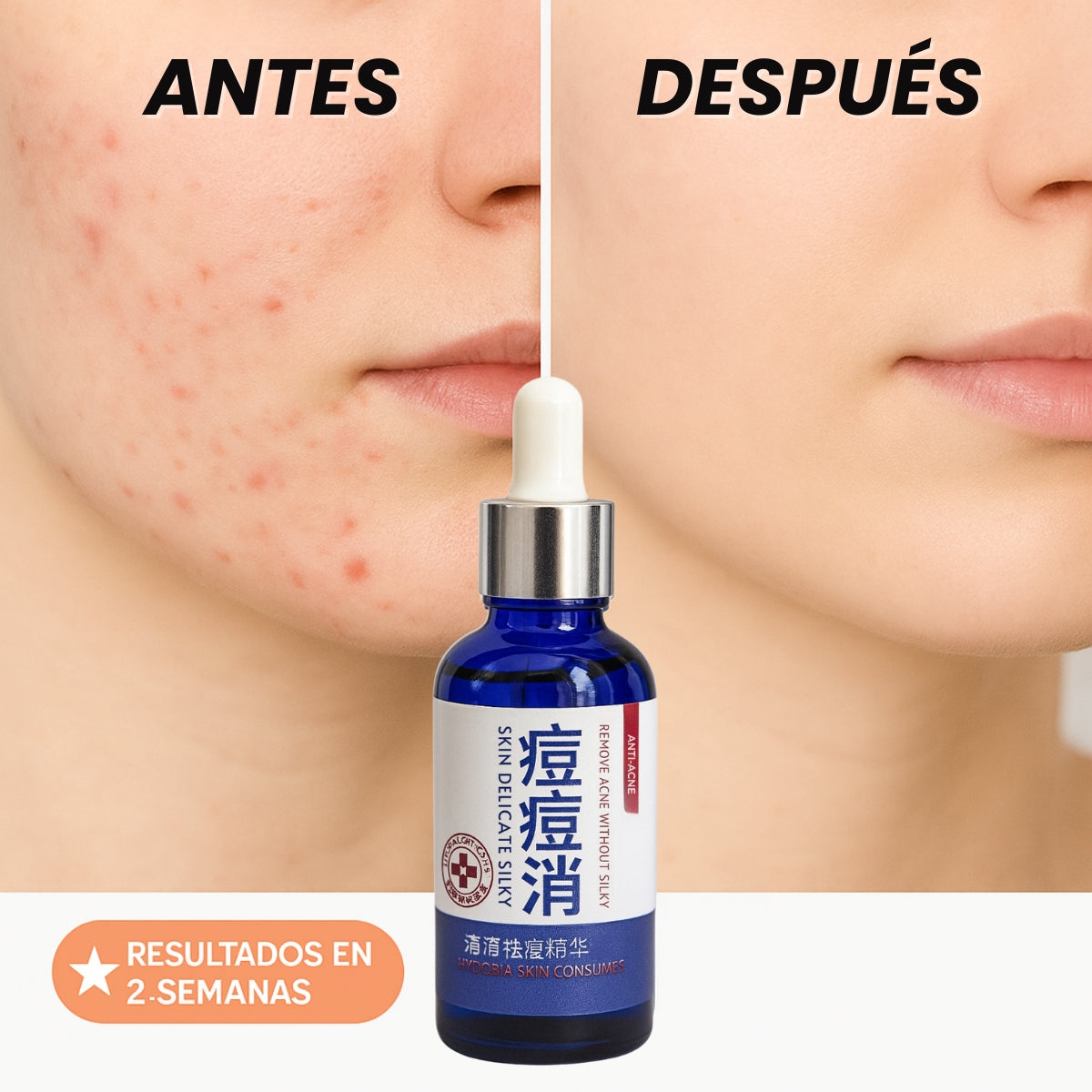 Serum Koreano Anti Acne Tu piel clara, sin drama.
