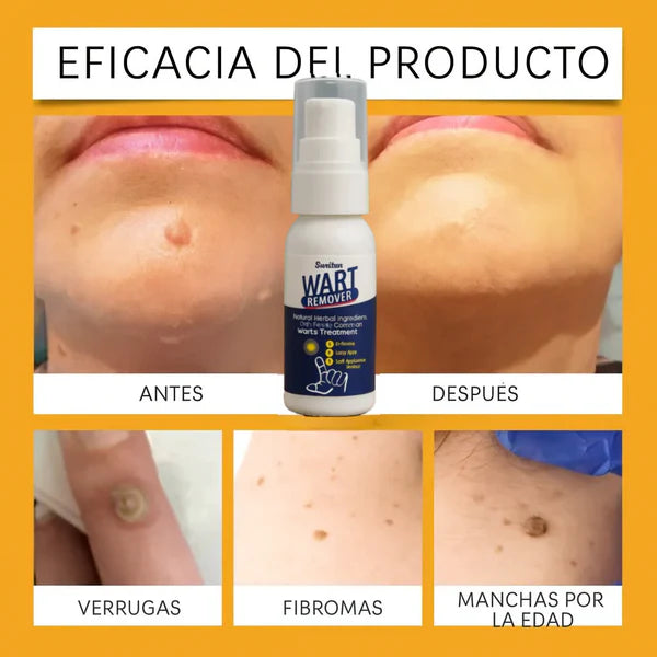 🤩Crema Removedora de Verrugas y Lunares Wart Remover | Elimina con suavidad y rapidez