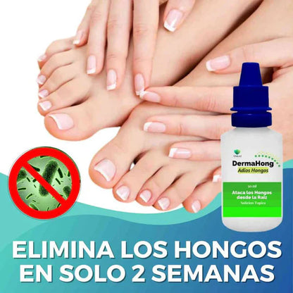 DermaHong Pro™ – Dile Adiós a los Hongos disminuye en 15 Días 🔥 Producto en tendencia